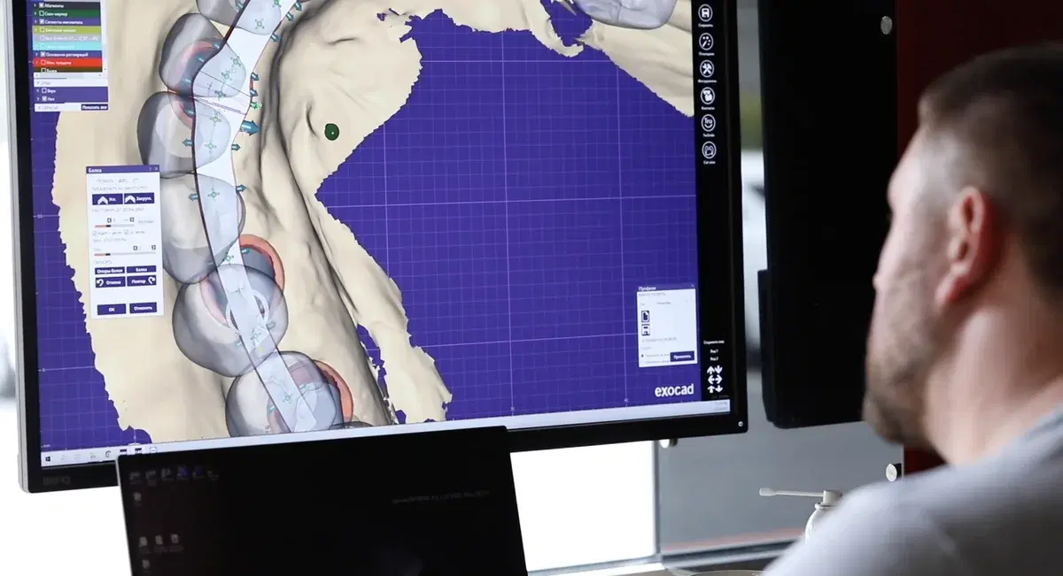 Guided Dental Implant Surgery: How 3D Planning Improves Accuracy