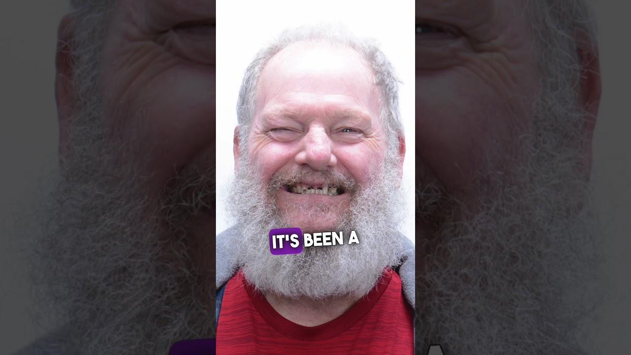 Full Arch Dental Implants Journey