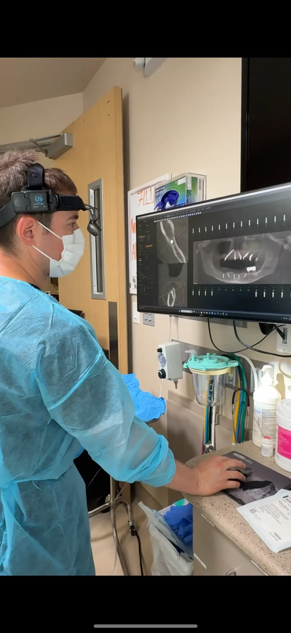 3D CBCT imaging and digital planning at Fusion Dental Implants Sacramento clinic