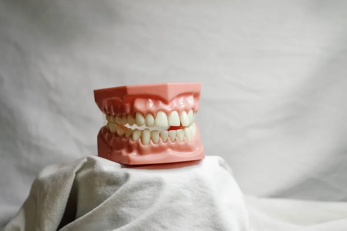 Dental model showing tooth extraction site and implant placement timing options