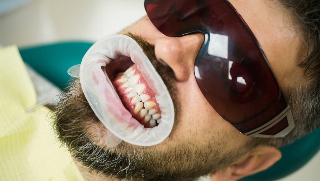 From Consultation to Your Perfect Smile