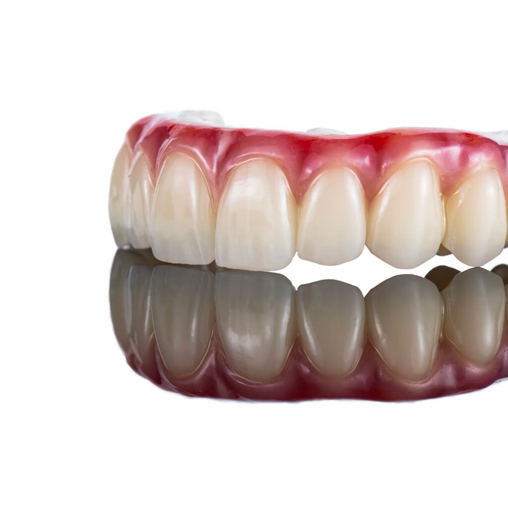 Premium dental implant services at Fusion Dental Implants