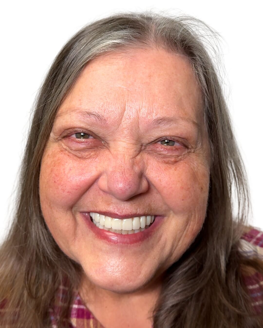 Patient after dental implant transformation showing beautiful new smile at Fusion Dental Implants