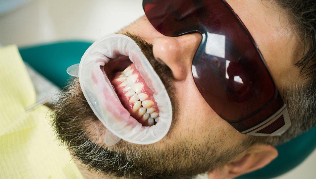 From Consultation to Your Perfect Smile