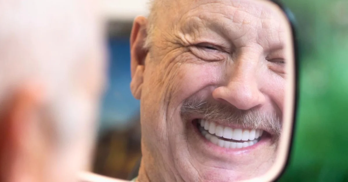Before and After All-on-4 Dental Implants: Real Cases