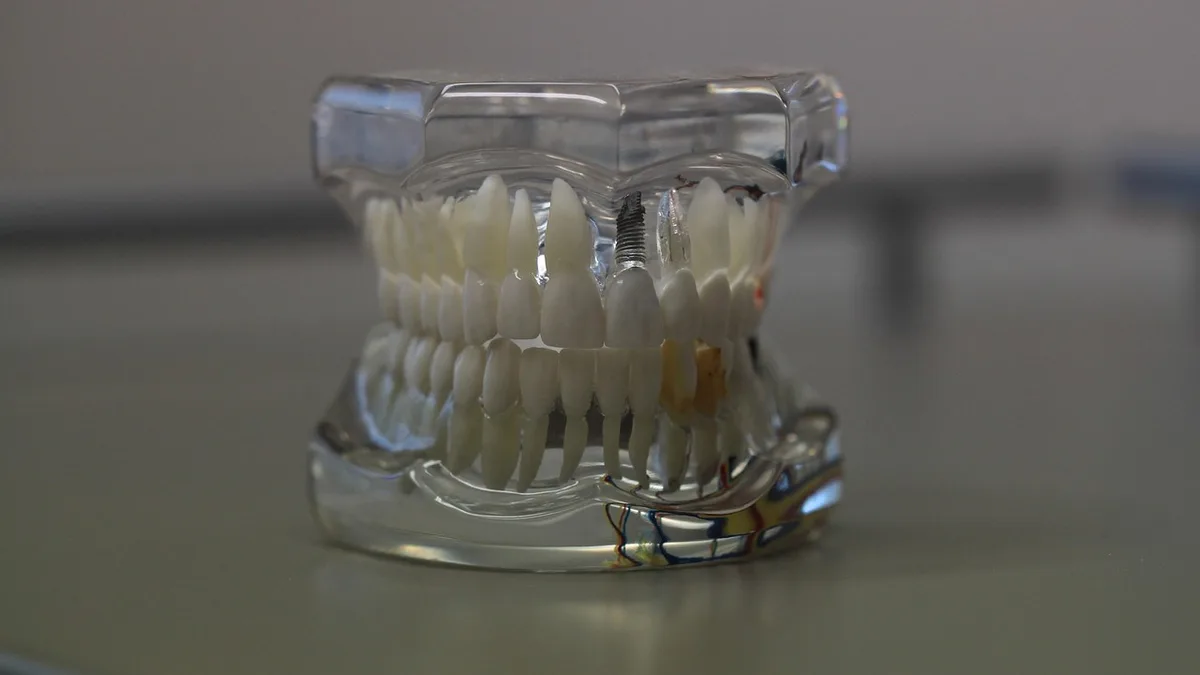 Dental Implants vs Dentures: Long-Term Comparison