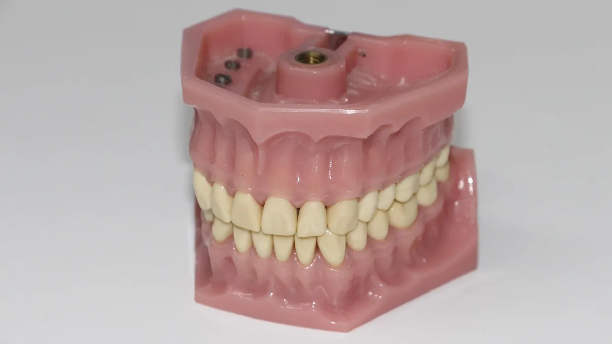 Full Mouth Dental Implants: Treatment Options
