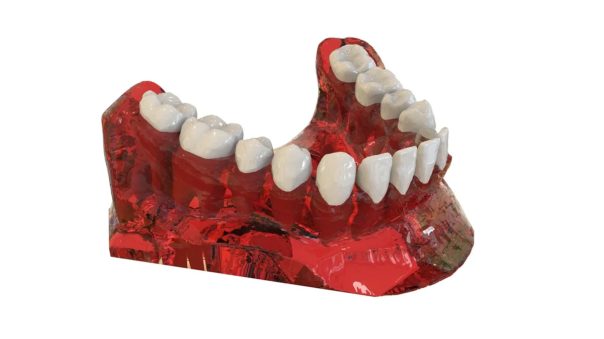 How Dental Implants Work: A Step-by-Step Guide