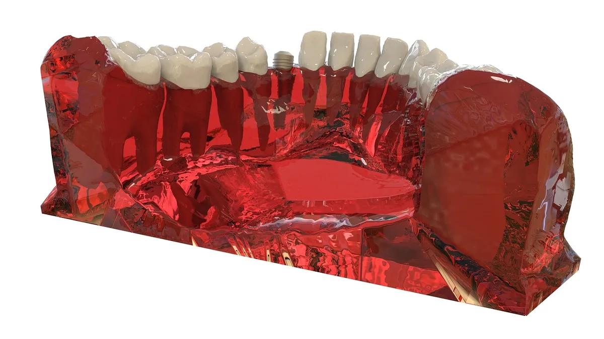 Snap-On Dentures: Complete Guide to Cost, Pros & Cons