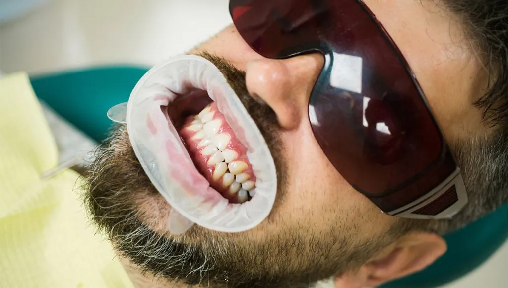From Consultation to Your Perfect Smile