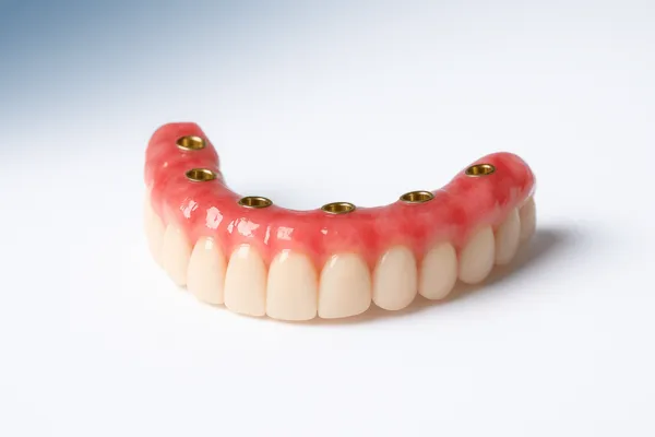 Bone Grafting & Sinus Lift