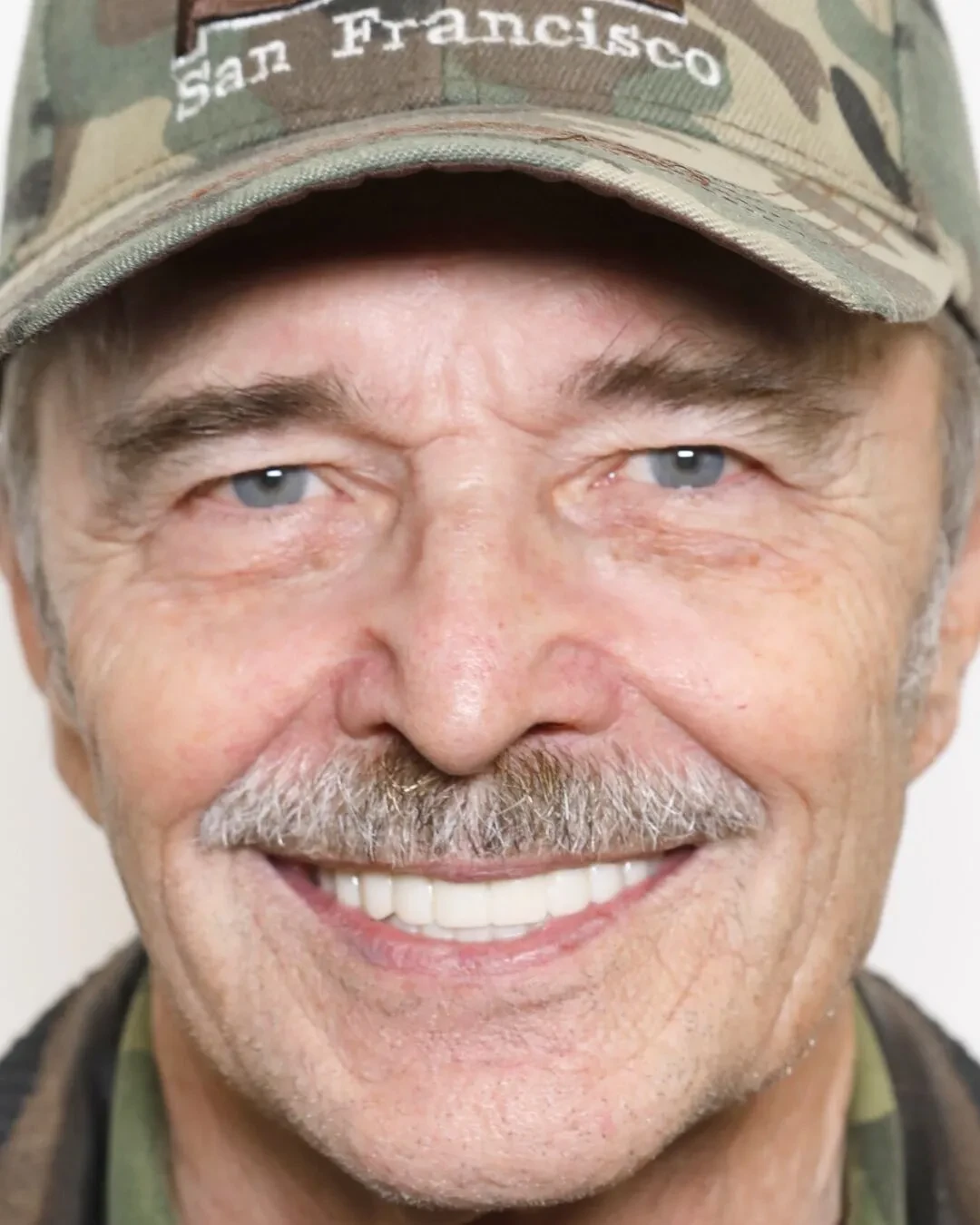 Patient 2 after dental implant procedure with natural-looking results