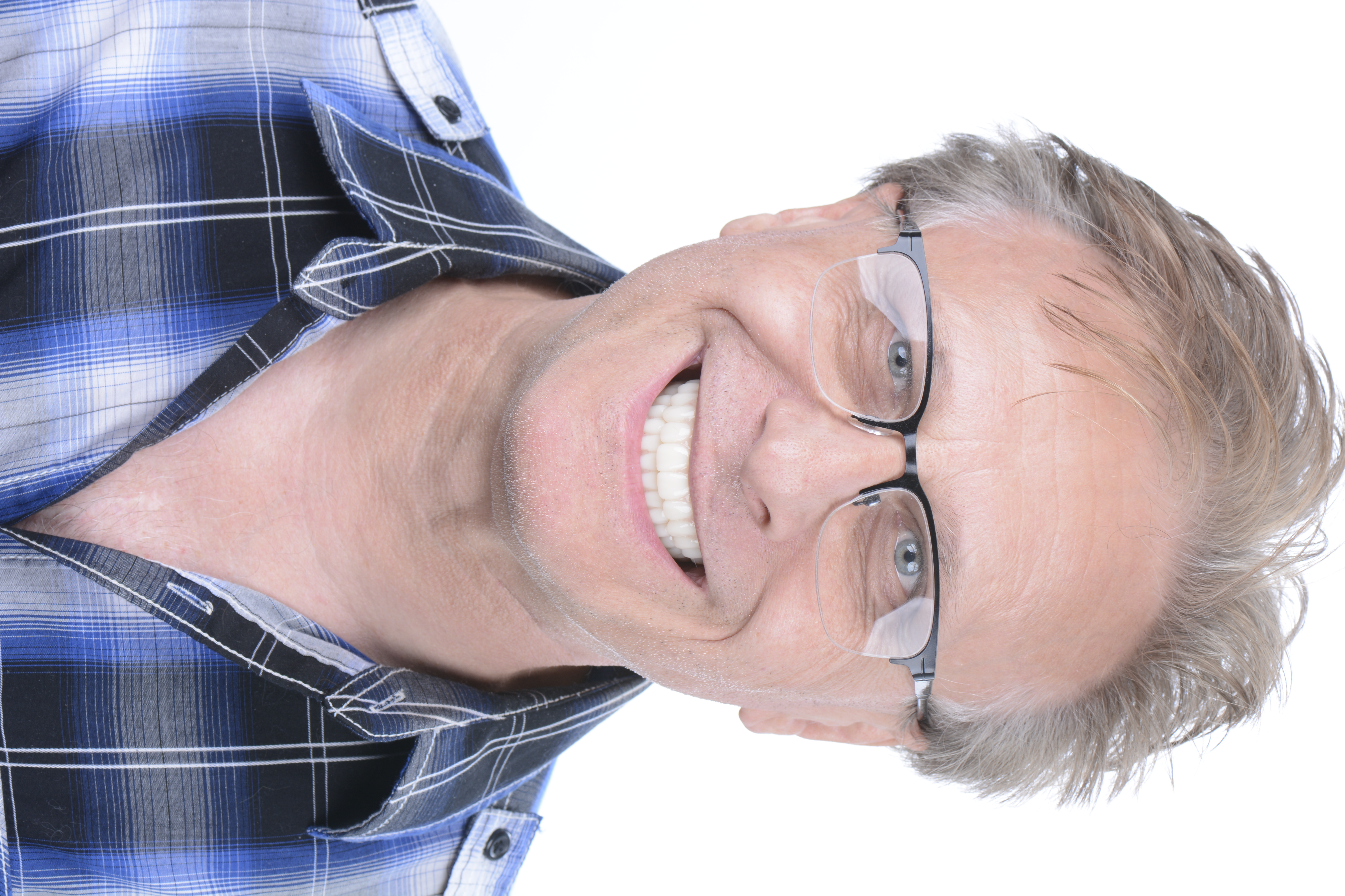 After - Dental implant transformation - confident new smile