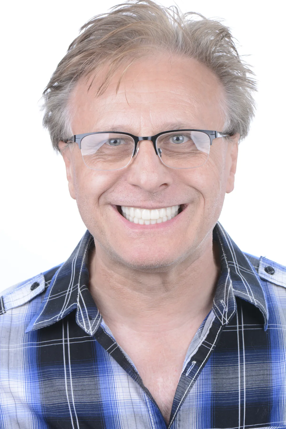 After - Dental implant transformation - confident new smile