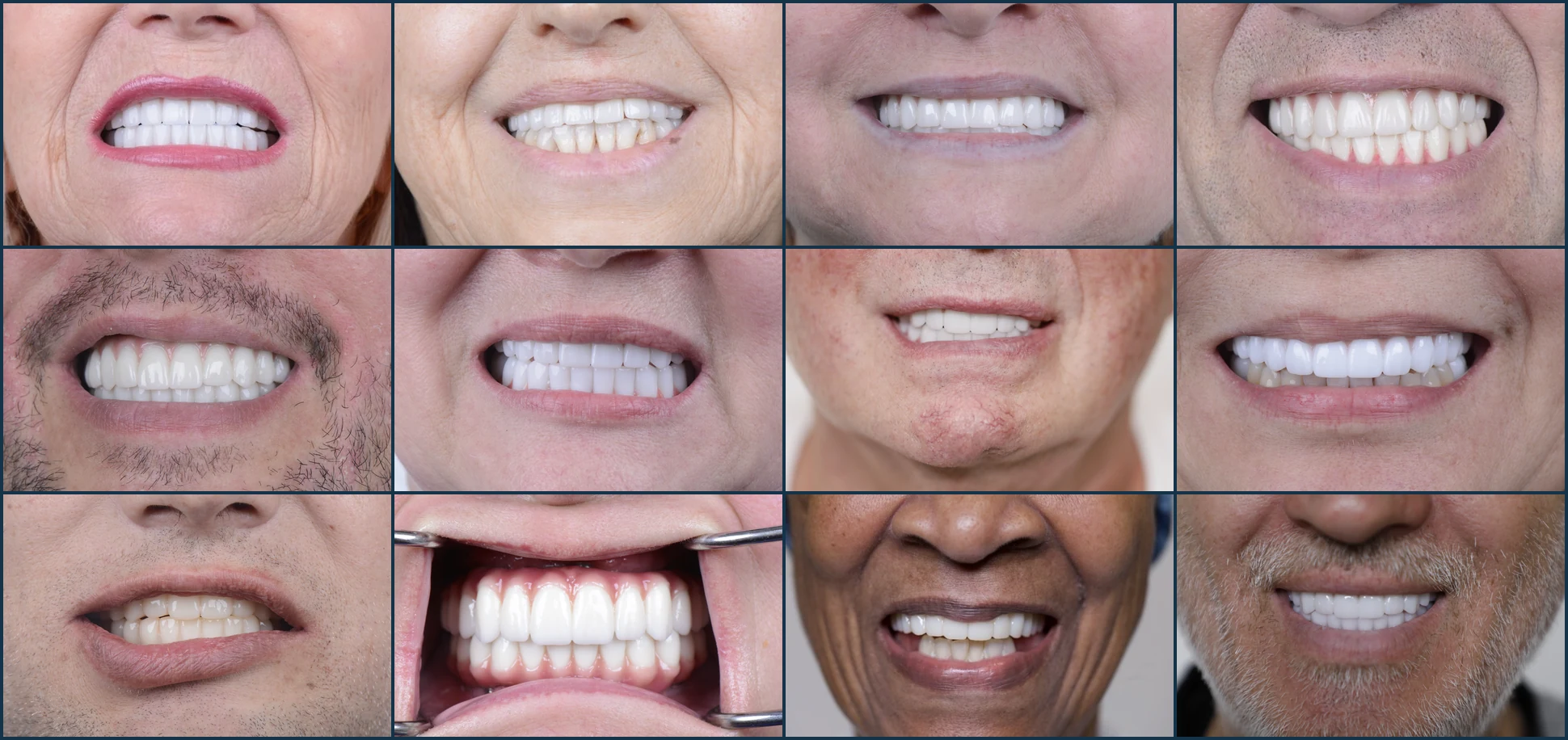 A collage of twelve patient smiles