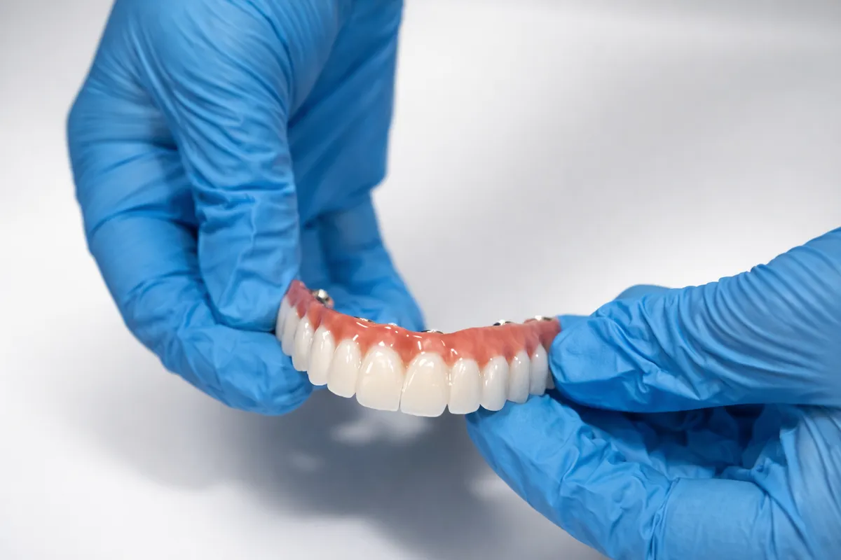 Zirconia dental prosthesis for full arch restoration
